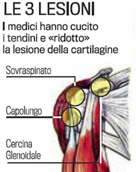 Effettuata con successo l'operazione alla spalla di Valentino Rossi Effettuata con successo l'operazione alla spalla di Valentino Rossi